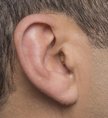 correctly fitted CIC hearing aid
